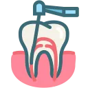 Dantų kanalų (endodontinis) gydymas