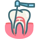 Dantų kanalų (endodontinis) gydymas