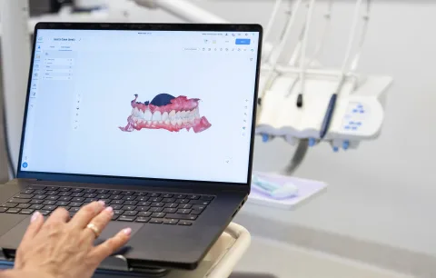 Digital bite model in dental software