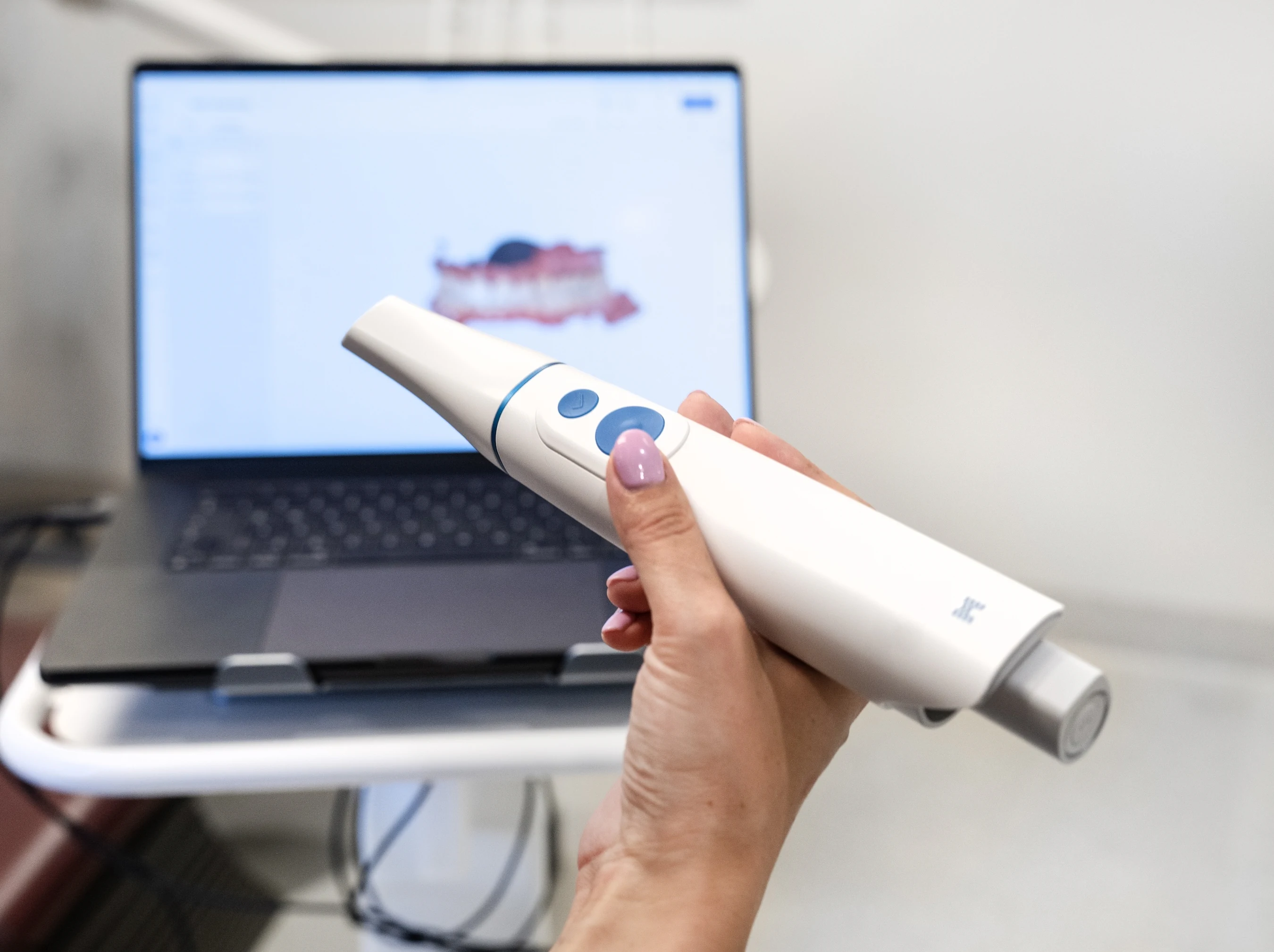 Intraoral scanner used to create a digital view of the mouth
