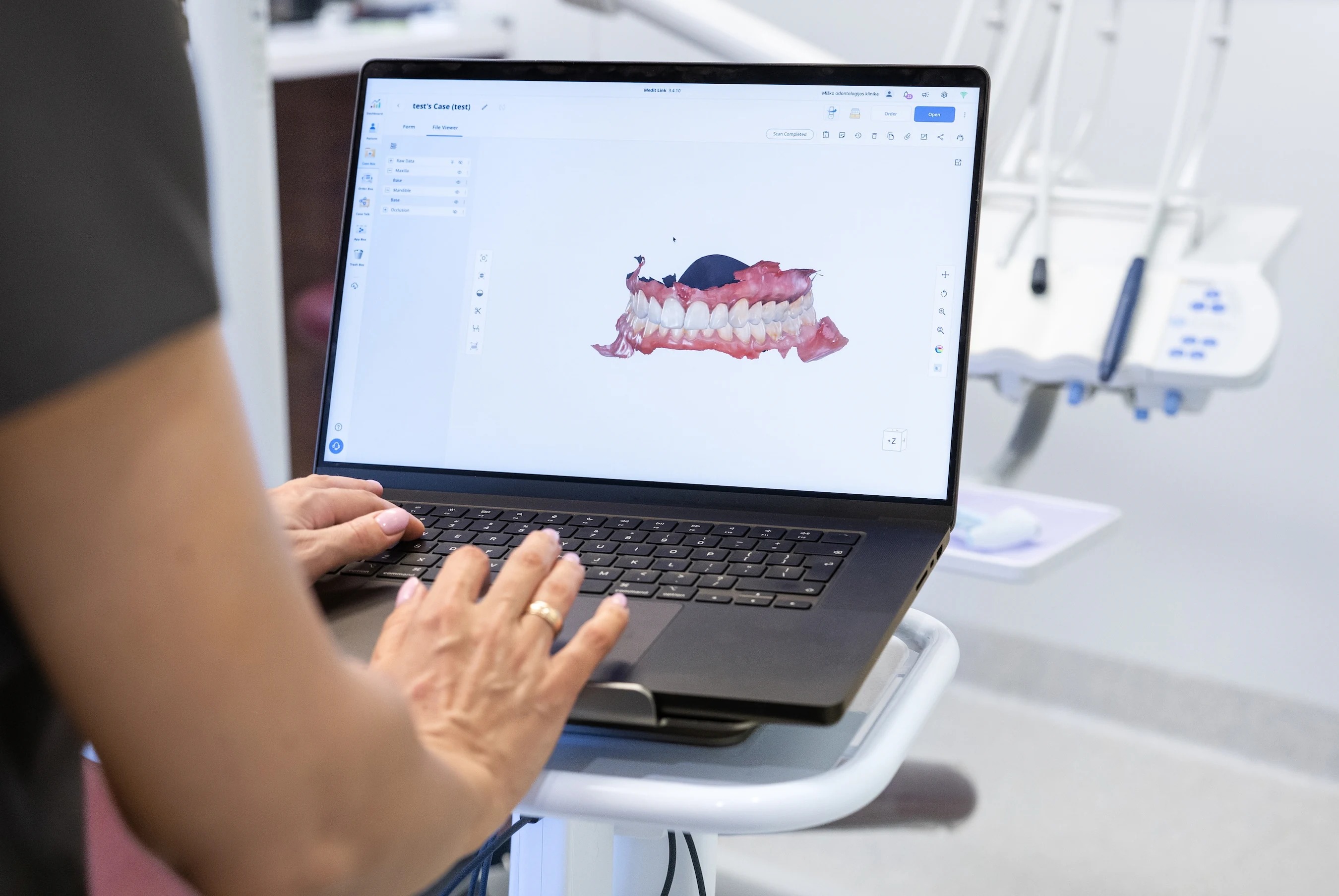 Digital model of teeth and gums in dental software